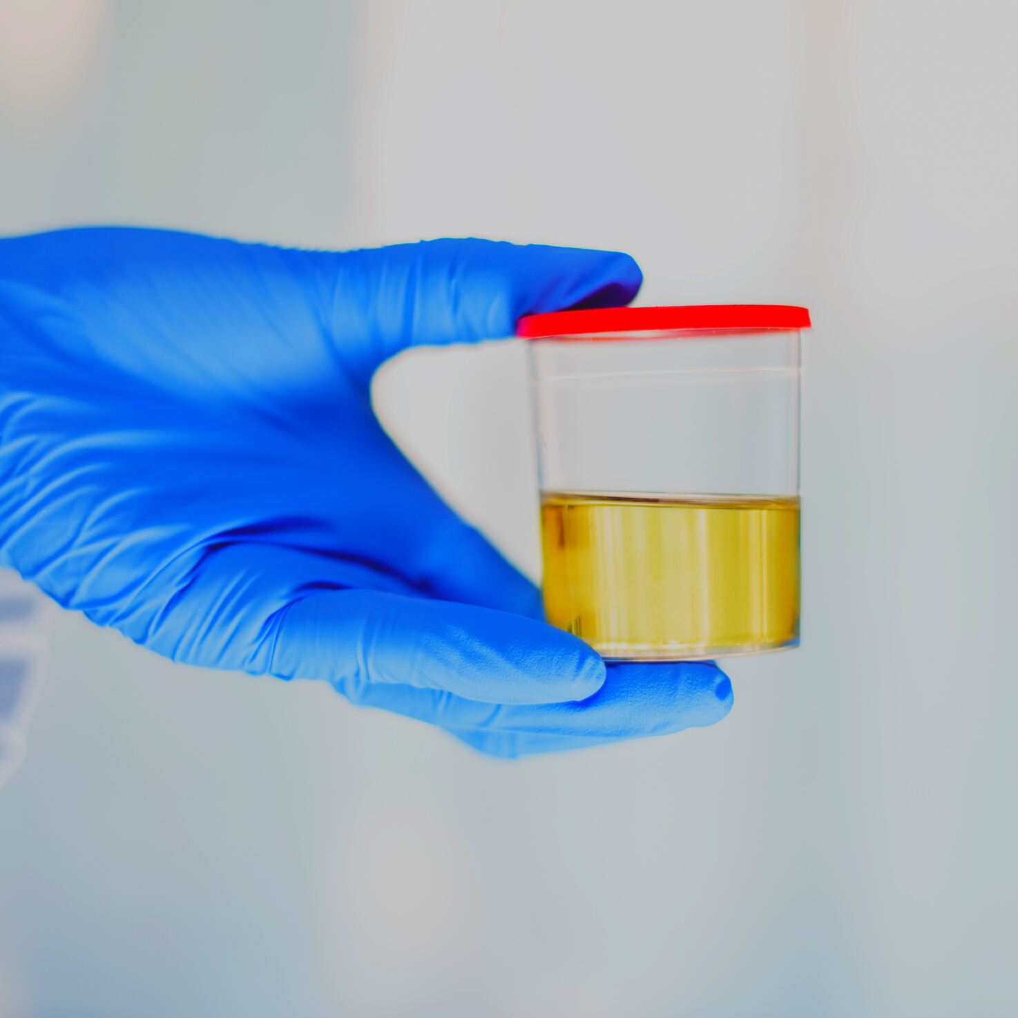 Urine Sample